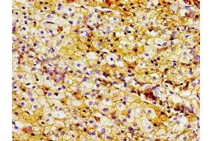 Immunohistochemistry of paraffin-embedded human adrenal gland tissue using ABIN7158300 at dilution of 1:100 (LTA4H antibody  (AA 107-311))