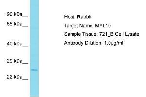 Host: Rabbit Target Name: MYL10 Sample Type: 721_B Whole Cell lysates Antibody Dilution: 1. (MYL10 antibody  (N-Term))