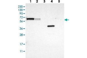 Western blot analysis of Lane 1: RT-4, Lane 2: U-251 MG, Lane 3: Human Plasma, Lane 4: Liver, Lane 5: Tonsil with GDF5 polyclonal antibody . (GDF5 antibody)