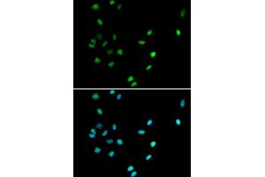Immunofluorescence analysis of A549 cells using RUNX1 antibody. (RUNX1 antibody)