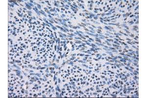 Immunohistochemical staining of paraffin-embedded pancreas tissue using anti-FCGR2A mouse monoclonal antibody. (FCGR2A antibody)