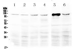 Western blot analysis of DDX58 using anti-DDX58 antibody . (DDX58 antibody  (AA 871-925))