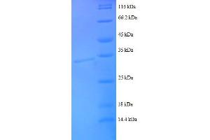 Chemokine (C-C Motif) Ligand 14 (CCL14) (AA 25-82), (partial) protein (GST tag) (CCL14 Protein (AA 25-82, partial) (GST tag))