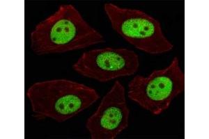 Immunofluorescent analysis of A549 cells using LIN28A antibody at 1:100. (LIN28A antibody  (AA 108-138))