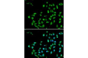 anti-Catenin, beta Like 1 (CTNNBL1) (AA 264-563) antibody