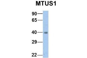 Host:  Rabbit  Target Name:  EGFL8  Sample Type:  HepG2  Antibody Dilution:  1. (MTUS1 antibody  (Middle Region))