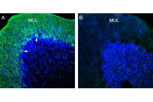 Expression of KCNT1 (Slack) in rat cerebellum. (Potassium Channel, Subfamily T, Member 1 (KCNT1) Peptide)