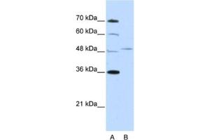 Western Blotting (WB) image for anti-Forkhead Box Q1 (FOXQ1) antibody (ABIN2461966) (FOXQ1 antibody)