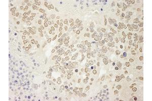 anti-Ubiquitin Specific Peptidase 15 (USP15) (C-Term) antibody