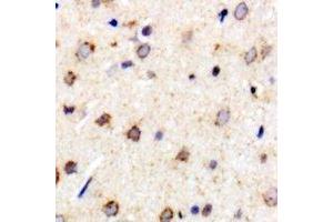 Immunohistochemical analysis of Metaxin-1 staining in rat brain formalin fixed paraffin embedded tissue section. (Metaxin 1 antibody)