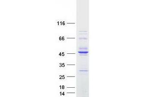 RCC1 Domain Containing 1 (RCCD1) (Transcript Variant 2) protein (Myc-DYKDDDDK Tag)