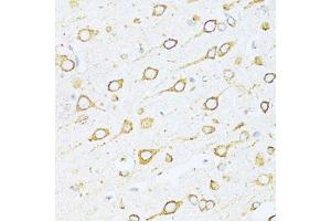Immunohistochemistry of paraffin-embedded rat brain using HSPA5 antibody. (GRP78 antibody  (AA 550-650))