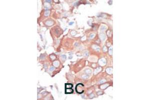 Immunohistochemistry (IHC) image for anti-Mitogen-Activated Protein Kinase Kinase Kinase 1 (MAP3K1) antibody (ABIN3003567)