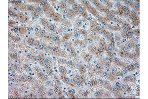 Immunohistochemistry (IHC) image for anti-Transient Receptor Potential Cation Channel, Subfamily M, Member 4 (TRPM4) antibody (ABIN1501531) (TRPM4 antibody)