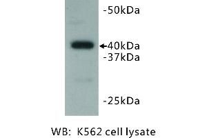 Image no. 2 for anti-BMI1 Polycomb Ring Finger Oncogene (BMI1) antibody (ABIN1112825)