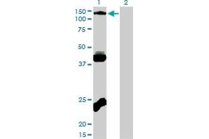 Western Blotting (WB) image for anti-EPH Receptor B3 (EPHB3) (AA 899-998) antibody (ABIN598667) (EPH Receptor B3 antibody  (AA 899-998))