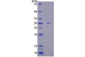 Image no. 1 for Ectonucleotide Pyrophosphatase/phosphodiesterase 2 (ENPP2) (AA 54-254) protein (His tag) (ABIN4989163) (ENPP2 Protein (AA 54-254) (His tag))
