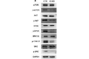 Human KBTBD8 regulated the activity of multiple cell cycle kinases in EOC cells. (MTOR antibody  (pSer2448))