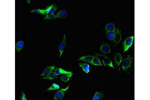 Immunofluorescent analysis of Hela cells using ABIN7176028 at dilution of 1:100 and Alexa Fluor 488-congugated AffiniPure Goat Anti-Rabbit IgG(H+L) (ZC4H2 antibody  (AA 1-224))
