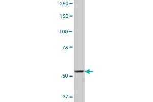 Western Blotting (WB) image for anti-SP110 Nuclear Body Protein (SP110) (AA 271-380) antibody (ABIN561432)
