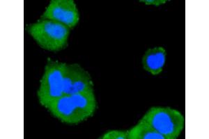 Immunofluorescence analysis of HeLa cells using MAPK14 antibody (ABIN5997045). (MAPK14 antibody)