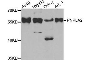 Western Blotting (WB) image for anti-Patatin-Like phospholipase Domain Containing 2 (PNPLA2) antibody (ABIN1882372) (PNPLA2 antibody)