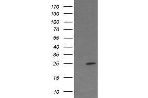 Image no. 3 for anti-Fetal and Adult Testis Expressed 1 (FATE1) antibody (ABIN1498225) (FATE1 antibody)