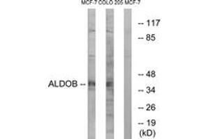 Western blot analysis of extracts from MCF-7/HuvEc cells, using ALDOB Antibody. (ALDOB antibody  (AA 111-160))