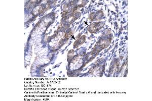 Human Stomach (TAB2 antibody  (N-Term))
