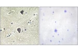Immunohistochemistry analysis of paraffin-embedded human brain tissue, using FGFR3 Antibody. (FGFR3 antibody  (AA 131-180))