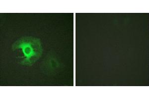 Peptide - +Immunofluorescence analysis of HeLa cells, using Caldesmon (Ab-789) antibody.