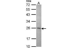 WB Image Sample (30 ug of whole cell lysate) A: Hep G2 , 12% SDS PAGE antibody diluted at 1:1000 (STXBP6 antibody  (N-Term))