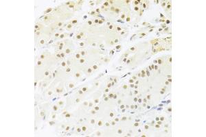 Immunohistochemistry of paraffin-embedded human stomach using RBPJ Antibody (ABIN1876876) at dilution of 1:100 (40x lens). (RBPJ antibody)