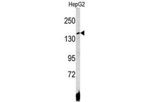 Image no. 1 for anti-ATPase, Cu++ Transporting, beta Polypeptide (ATP7B) (C-Term) antibody (ABIN452773) (ATP7B antibody  (C-Term))