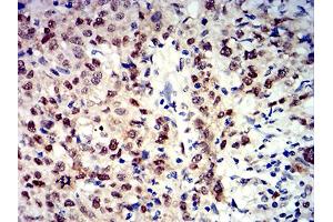 Immunohistochemistry (IHC) image for anti-Apurinic/Apyrimidinic Endonuclease 1 (APEX1) (AA 219-318) antibody (ABIN5611191)