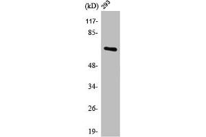 Western Blot analysis of 293 cells using POTE14/22 Polyclonal Antibody (POTEG/POTEH/POTEM (C-Term) antibody)
