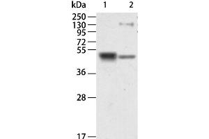 Western Blot analysis of Human kidney and Mouse brain tissue using RAGE Polyclonal Antibody at dilution of 1:750 (RAGE antibody)
