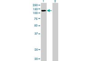 Western Blot analysis of DDX42 expression in transfected 293T cell line by DDX42 MaxPab polyclonal antibody. (DDX42 antibody  (AA 1-819))