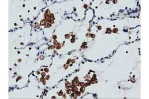 Immunohistochemical staining of paraffin-embedded Human colon tissue using anti-ARHGAP25 mouse monoclonal antibody. (ARHGAP25 antibody)