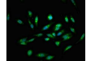 Immunofluorescent analysis of Hela cells using ABIN7146404 at dilution of 1:100 and Alexa Fluor 488-congugated AffiniPure Goat Anti-Rabbit IgG(H+L) (ATP2C1 antibody  (AA 491-605))