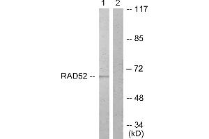 Immunohistochemistry analysis of paraffin-embedded human braIin tissue using DRP-2 (Ab-514) antibody.