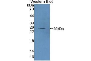 Western Blotting (WB) image for anti-N-Acetylgalactosaminidase, alpha (NAGA) (AA 18-217) antibody (ABIN1176638) (NAGA antibody  (AA 18-217))