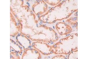 IHC-P analysis of kidney tissue, with DAB staining. (INSRR antibody  (AA 1090-1295))