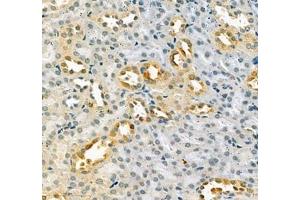 Immunohistochemistry of paraffin embedded mouse kidney using LOXL4 (ABIN7074541) at dilution of 1:400 (400x lens) (LOXL4 antibody)