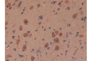 Detection of MYH6 in Rat Brain Tissue using Polyclonal Antibody to Myosin Heavy Chain 6, Cardiac Muscle, Alpha (MYH6) (MYH6 antibody  (AA 419-666))