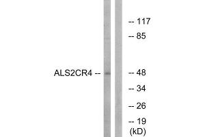 Western Blotting (WB) image for anti-Transmembrane Protein 237 (TMEM237) (Internal Region) antibody (ABIN1850757) (TMEM237 antibody  (Internal Region))