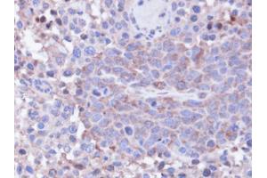 IHC-P Image Immunohistochemical analysis of paraffin-embedded SAS xenograft, using PPP1CC, antibody at 1:100 dilution. (PPP1CC antibody  (Center))