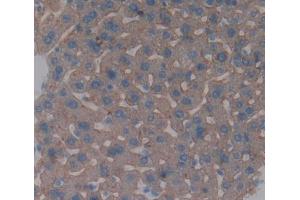 Figure. (IL-6 Receptor antibody  (AA 52-204))