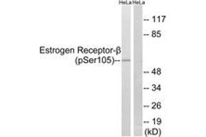 Western blot analysis of extracts from HeLa cells, using Estrogen Receptor-beta (Phospho-Ser105) Antibody. (ESR2 antibody  (pSer105))