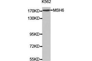 Western Blotting (WB) image for anti-MutS Homolog 6 (E. Coli) (MSH6) antibody (ABIN1873754) (MSH6 antibody)